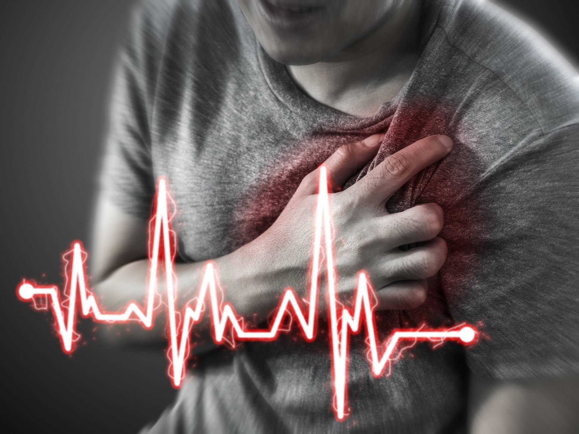 Cardiac Arrest: Symptoms, Causes, and Treatment